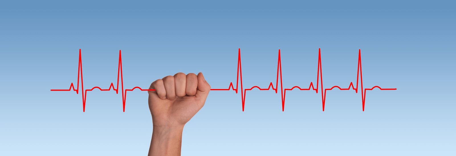 Heart Attack: Symptoms, Risks, Conditions, Treatment, and Prevention