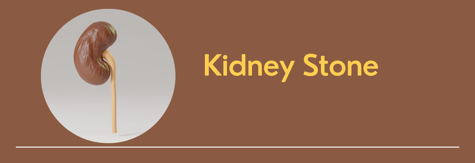 Kidney Stone – Types, Causes, Symptoms, Prevention, & Treatment