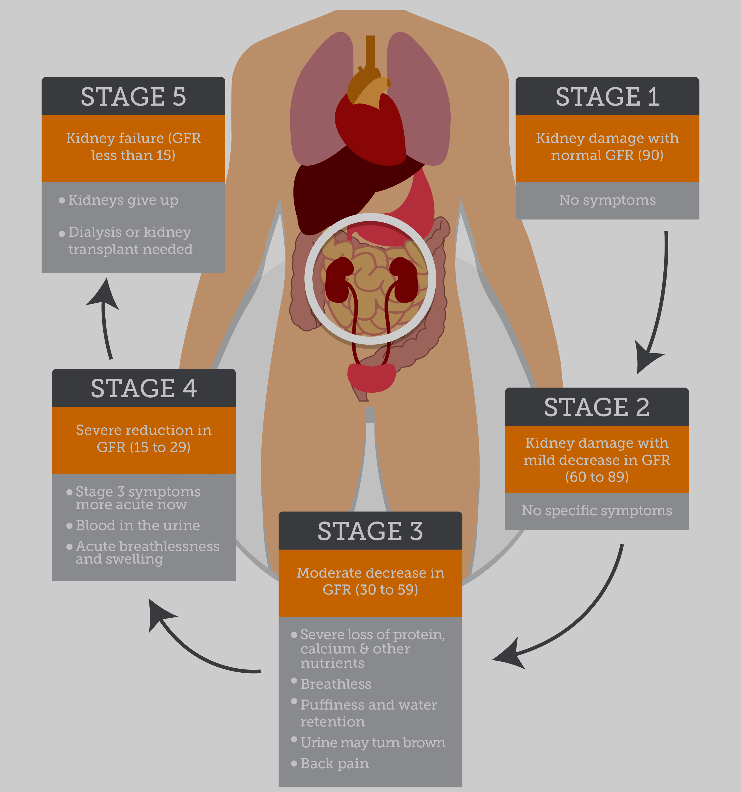 Diabetic nephropathy symptoms