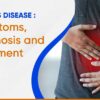 Crohn’s disease Symptoms, Diagnosis and Treatment