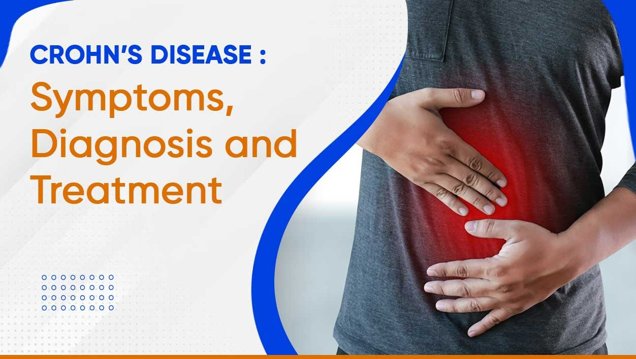Crohn’s disease : Symptoms, Diagnosis and Treatment