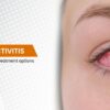 Conjunctivitis: Types, causes , treatment options