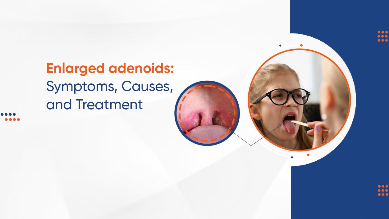 Enlarged Adenoids: Symptoms, causes, and treatment