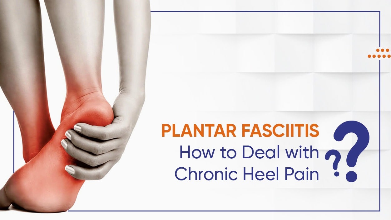 Plantar fasciitis: How to Deal with Chronic Heel Pain?
