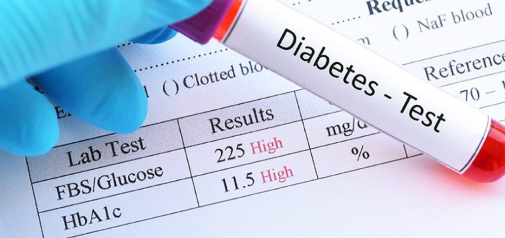 Fasting blood sugar vs HbA1c diabetes blood test