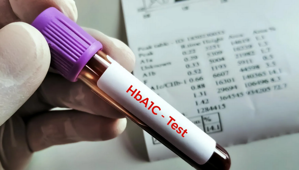 HbA1c blood test results diabetes monitoring