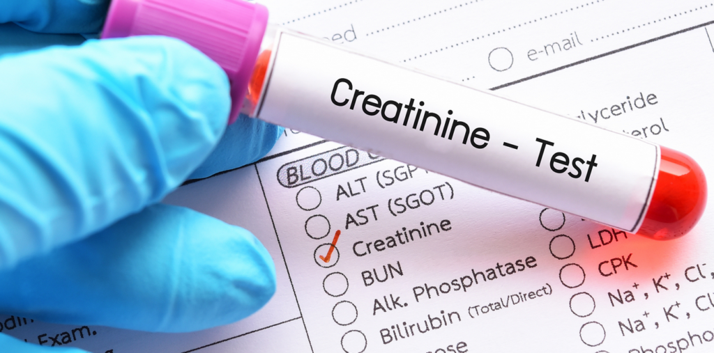 Creatinine levels kidney blood test results infographic