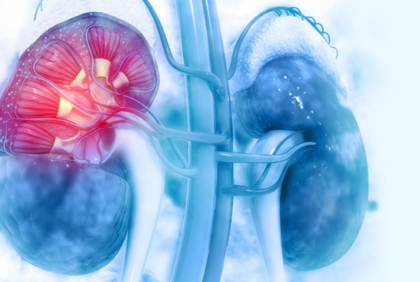 Diabetes causing kidney damage diabetic nephropathy