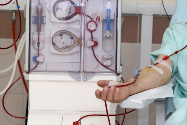 Dialysis procedure infographic showing hemodialysis and peritoneal dialysis